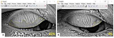 Analysis of Ocular Surface Characteristics and Incidence of Dry Eye Disease in Systemic Lupus Erythematosus Patients Without Secondary Sjögren's Syndrome